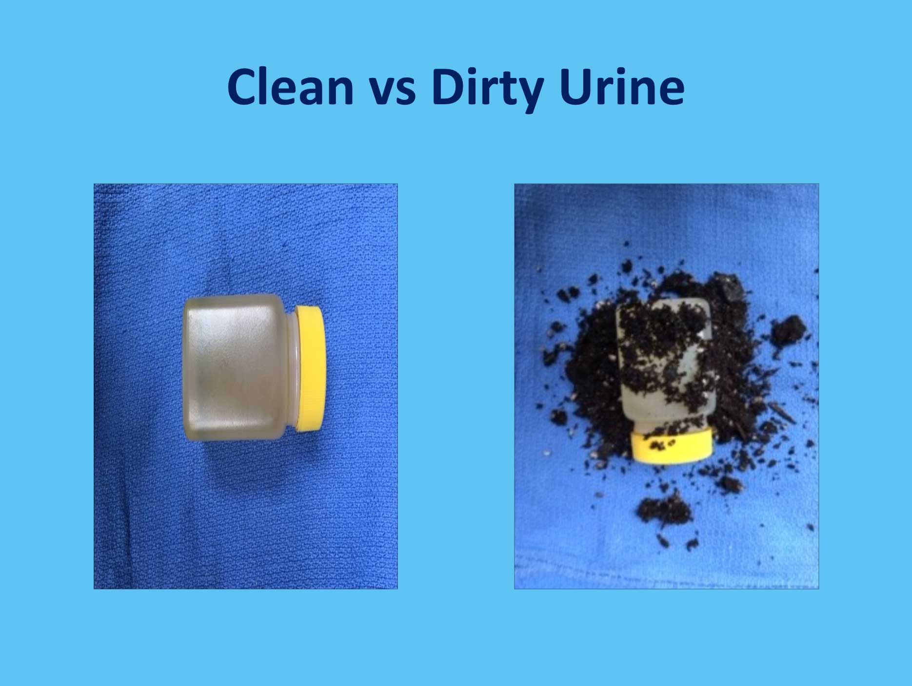 Clean vs Dirty Urine